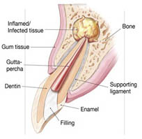 Endodontist in AECS Layout