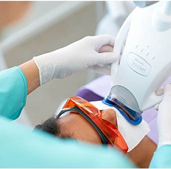 Teeth Whitening in AECS Layout