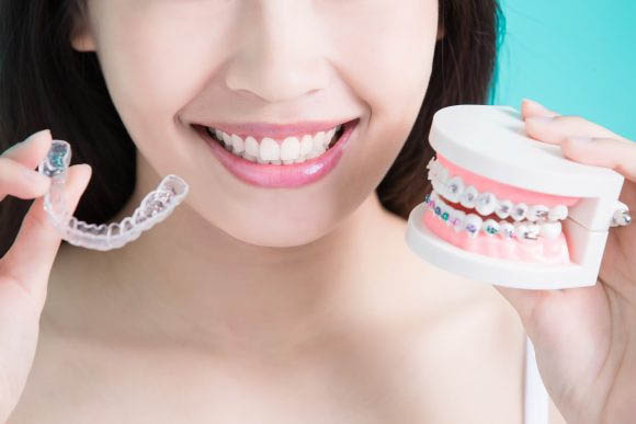 Invisalign Braces in AECS Layout