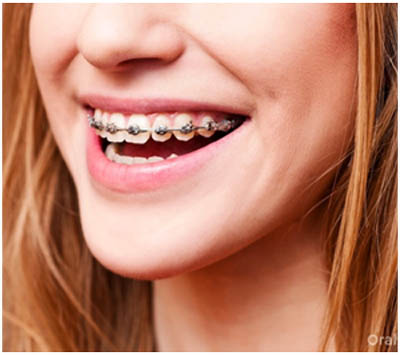 Top Orthodontist in Bangalore