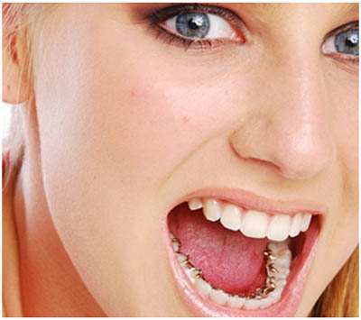 Top Orthodontist in Whitefield
