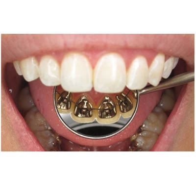 Best Orthodontist in Bangalore