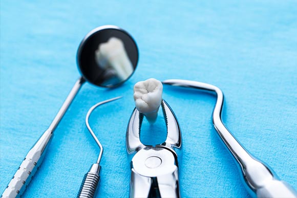 Wisdom teeth removal in Brookfield