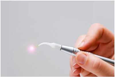 Laser Dentistry in AECS Layout