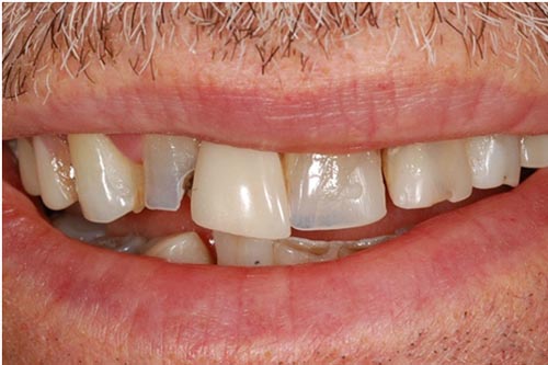 Cosmetic dentistry in AECS Layout