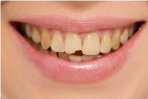 Cosmetic dentistry in Brookfield