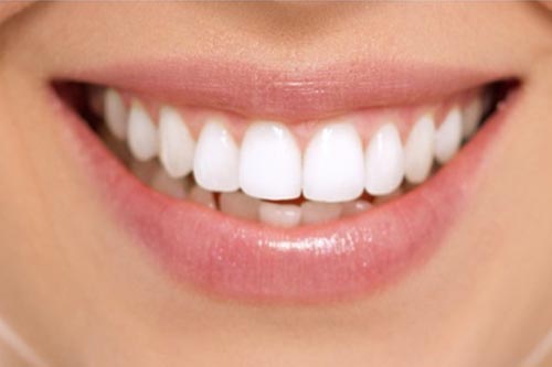 Smile Makeover in Marathahalli